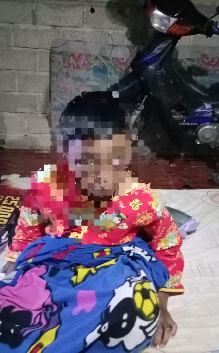 Anak Berumur 11 Tahun Babak Belur Dianiaya Bapak Tiri
